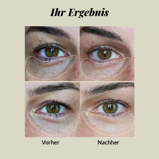 Ögonkräm - CBD + Hyaluronsyra